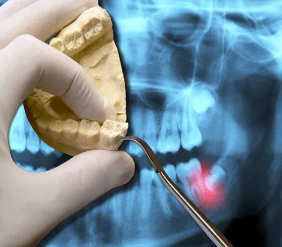 cad-cam-treatment