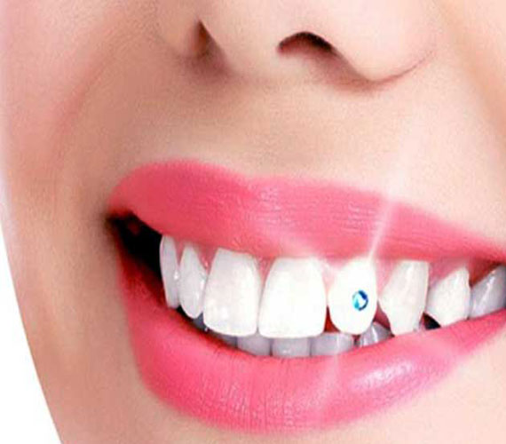 dental-jewellery-treatment