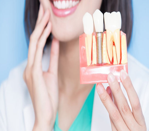 fixed-teeth-in-72-hours